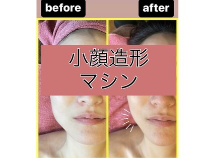 グラナーダ(granada)の写真