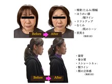 肩こり/リンパ/ヘッド/小顔/つぼ/フェイシャル/整体/矯正