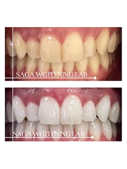 佐賀ホワイトニングラボ/