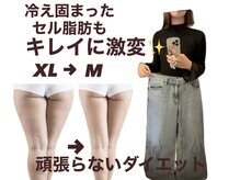 ヨサパーク ルポ(YOSA PARK ropos)