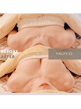 サロン ヴィプラス(SALON Vi+)/初回バストケアのBeforeAfter