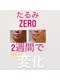 ビューティークリニーク アマーレ(Amare)の写真/あの頃に帰りたい・・・お顔・首・鎖骨・頭皮からアプローチ。結婚式直前SOSレスキュー☆