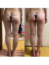 ピアリーノ(Pialino)/