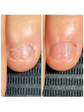 ウェルズユキ(well's yuki)/ピンクの部分を伸ばしたい