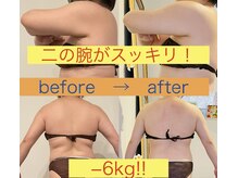 マナリノ(Mana Lino)/-6kgの劇的変化！！