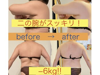 マナリノ(Mana Lino)/-6kgの劇的変化!!