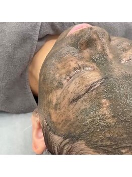 シミしわ改善！予防ケア