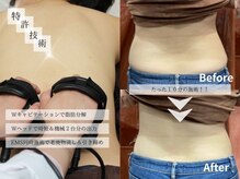 スズ(SUZU)の雰囲気（究極痩身＊体質ケア×デトックス痩身）