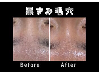 エステティック レイビス 銀座店(RAYVIS)/