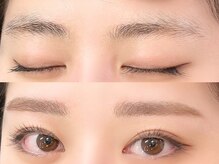 フレックル(freckle)