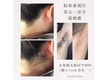 デミーナボーテ(DemynaBeaute)の雰囲気（キワまで攻める！驚くほど抜ける脱毛！美容に毛は要らない！☆）
