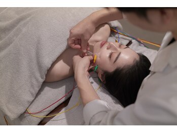 銀座ハリッチ 銀座本院の写真/【首・肩の重だるさ集中ケア！】鍼施術×微弱電流で首や肩をふわっと軽く。蓄積した疲れをリセット♪
