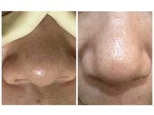 デューン 蕨店(Dune)/before/after 40代前半女性