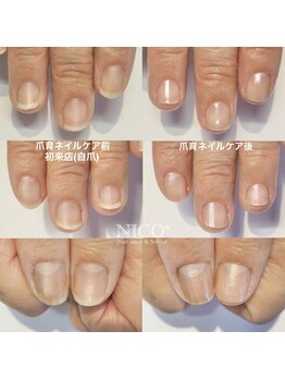 ニコプラス(NICO+)/ハンド爪育ネイルケア