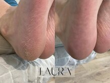 LAURA　NAIL【ローラ】【5月1日OPEN（予定）】