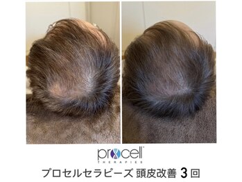 レイ(Rei)/頭皮プロセルセラピーズ
