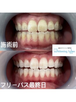 ホワイトニングサロン 熊本店/ホワイトニングサロン熊本店