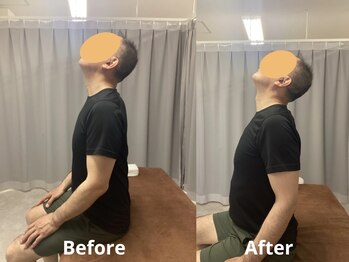 タダス 有楽町本院(TADASU)/初回 肩こり 20代