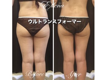 エレーナ 横浜(Ellena)/