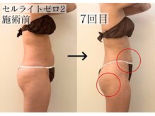 サロン カピリナ(salon Kapilina)の雰囲気（旭川初導入！凸凹脂肪にアプローチ【before→afterはブログへ】）
