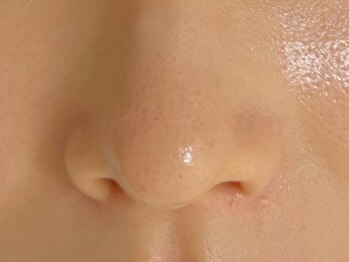 1002(トウフ)の写真/【韓国最新肌管理◎】ダウンタイムなしでお肌を労りながら、憧れのすっぴん陶器肌に♪あらゆるお肌悩みに◎