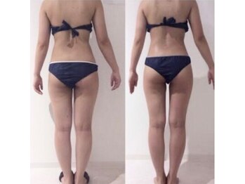 リノレア(Lino_Lea)/【気になる部位のみ施術】