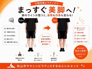 シルエットの写真/【猫背・O脚・側弯対応】初回体験11000円→口コミ投稿で無料!完全個室マシンピラティスで姿勢改善!ペア◎