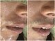 ティーダグー(Tiida guu)の写真/清潔感アップをサポート！気になる部位を選べる脱毛が可能でメンズも通いやすい♪