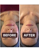 小顔コルギサロン シー(She)/【コルギ】1度の変化!