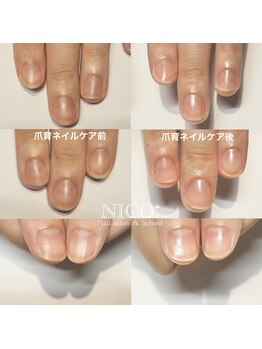 ニコプラス(NICO+)/ハンド爪育ネイルケア