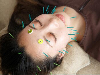 プライムライフ(prime-life)の写真/《小顔リフトアップには美容鍼》表情筋の奥からアプローチ！骨格や筋肉を見極めて美小顔へ導きます!