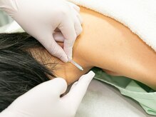 名古屋トリガーポイント鍼灸院/ 首・肩・頭の施術