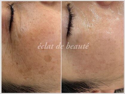 エクラデボーテ(eclat de beaute)の写真