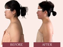 アンリール(Anrire)/【板橋/フェイシャルエステ】