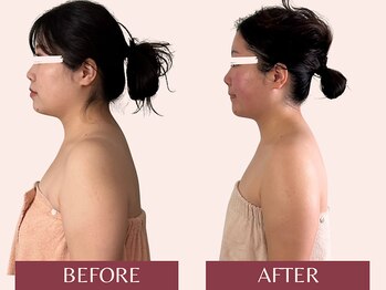 アンリール(Anrire)/【板橋/フェイシャルエステ】