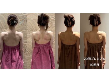 ロココ 豊田店(Rococo)/ビフォーアフター