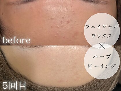 リネ(Rine)の写真