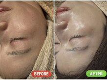 リマイン(Re mine)の雰囲気（濃いシミや毛穴もツルっと肌へ。大人ツヤ肌で輝かせます！）