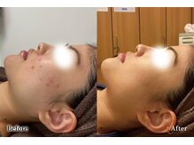 アネル 新都心店(anel)/