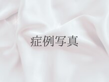 スレーン 上本町(Serein)/