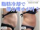 クレビア(Clevia)の写真