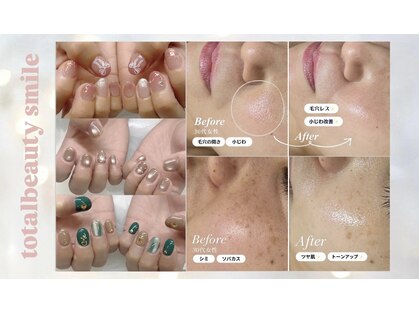 スマイル(SMILE)の写真