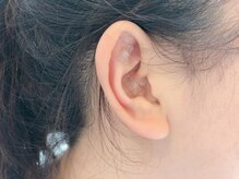 ヘルシースリムウエダの雰囲気（【耳ツボダイエット・スリム鍼】もう悩まない！健康キレイ痩せ）