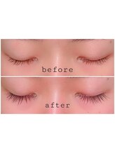 ケイラッシュ(K-LASH)/エグータム1ヶ月使用のお客様♪