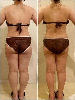 モカ(MOKA)/肩甲骨がキレイに出て背中美人★