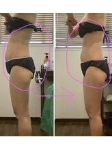 エステティックジュネス(JEUNESSE)/全身スリムマッサージ 発汗付き