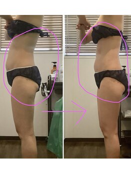 エステティックジュネス(JEUNESSE)/全身スリムマッサージ 発汗付き