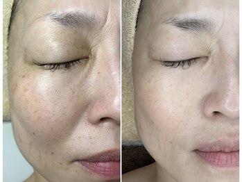 10 ポイント K 目黒(10 POINT. K)