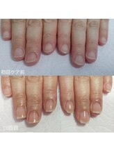 エヌプラス(Nplus)/美爪育成３ヵ月コース