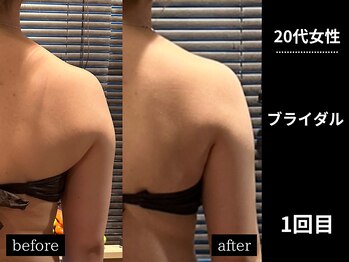 ミーツ(MEETS)/肩と腕が気になる/ブライダル